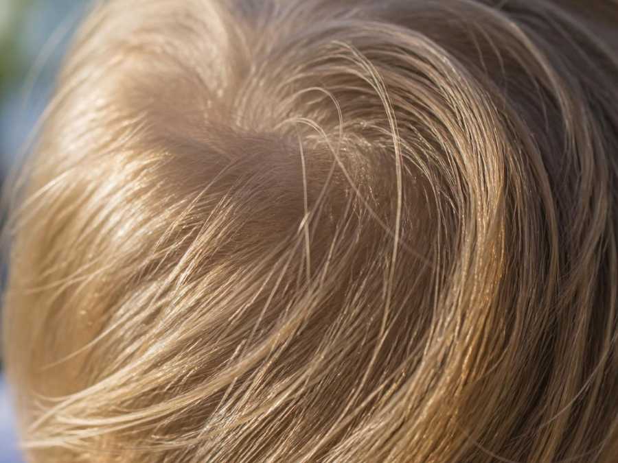 understanding-your-child's-hair-fine-hair