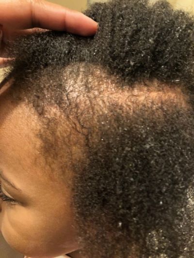 children-natural-hair-breakage