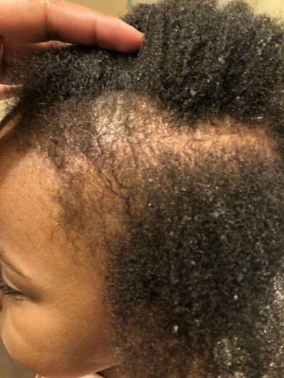 natural-children-hair-breakage