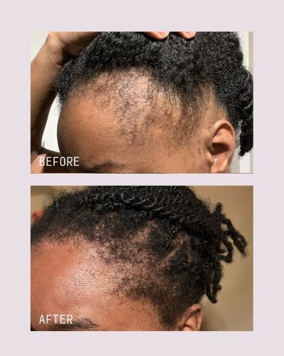 children natural hair-growth-vs-hair-breakage