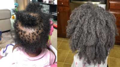 hair-growth-vs-hair-breakage