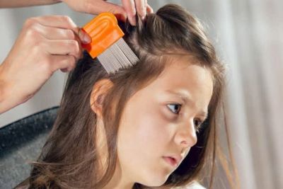 little-girl-hairline