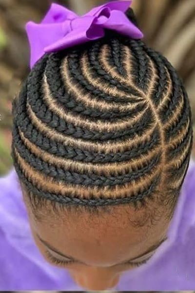 sensitive-scalp