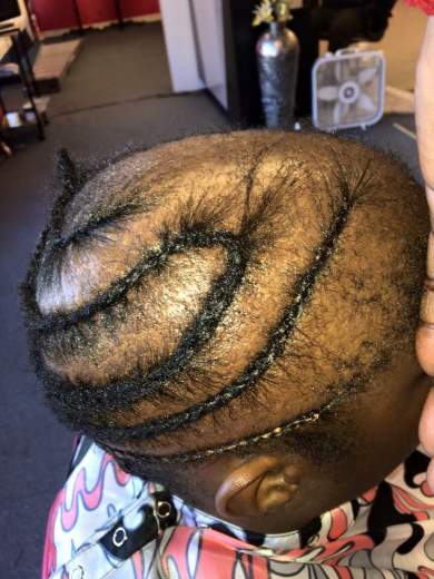 child-hair-friction-can-affect-the-hairline